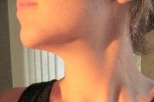 Imagen ilustrativa del artículo Gimnasia facial para fortalecer el cuello