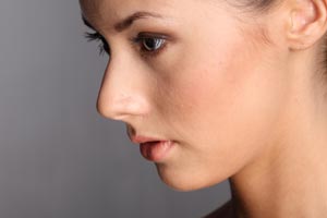 Imagen ilustrativa del artículo Remedios naturales contra las venas rojas de la cara (Cuperosis)