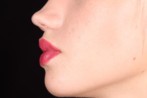 Imagen ilustrativa del artículo Trucos de maquillaje que disimulan la papada